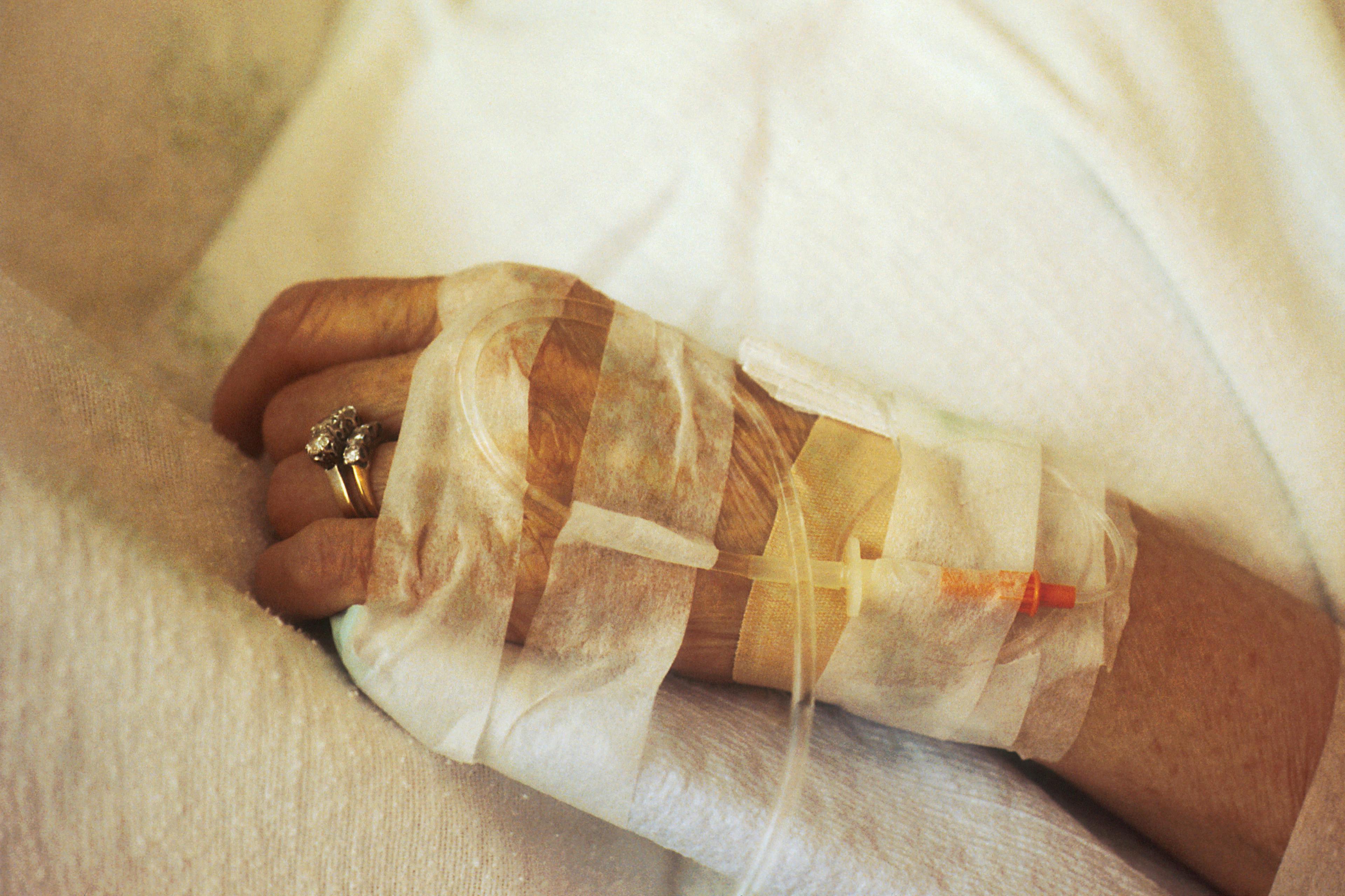 closeup of chemotherapy IV in patient's hand