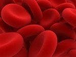 Correcting Anemia From Heavy Menstrual Bleeding Can Improve QOL