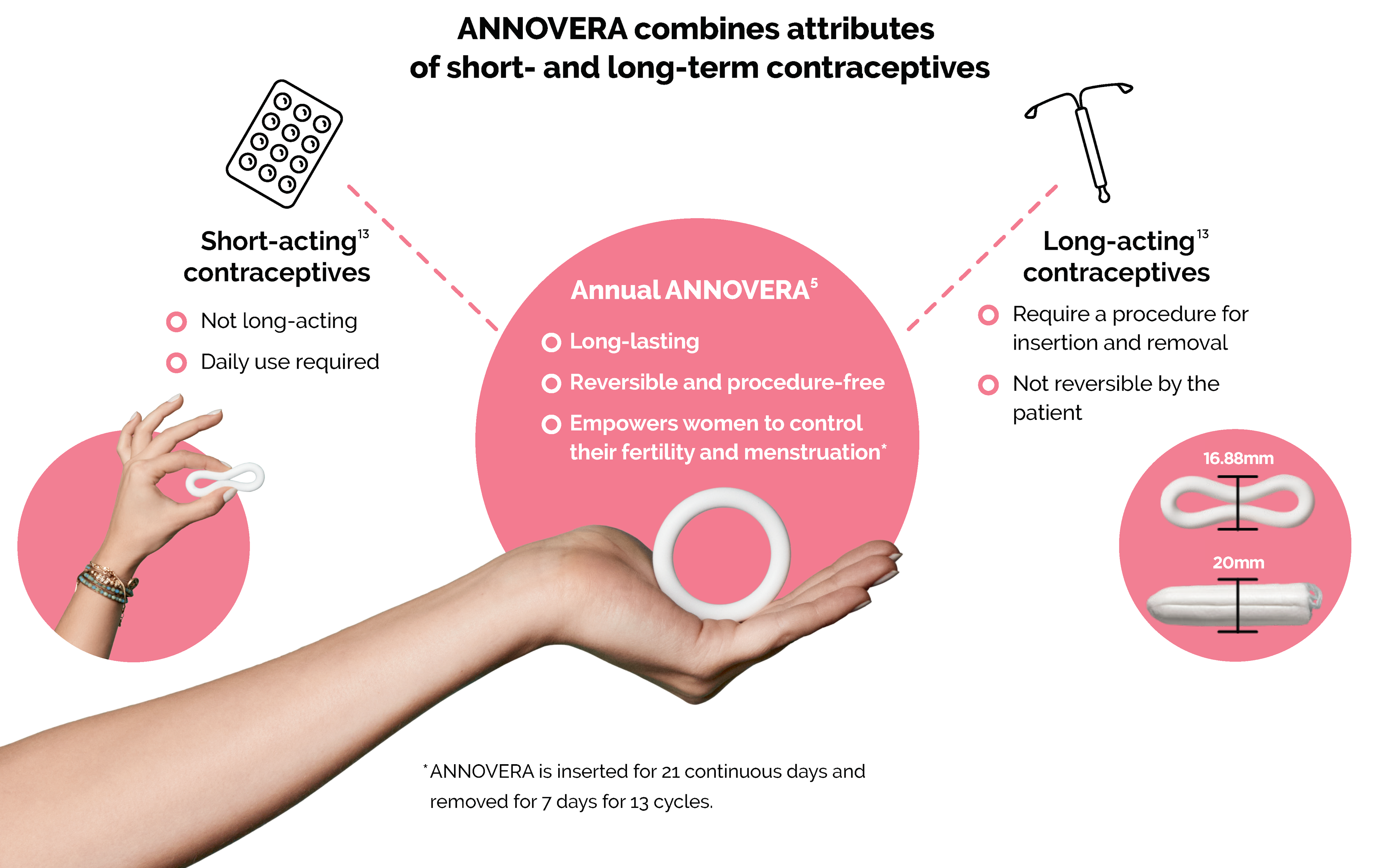 Annovera: The First Long-Lasting, Reversible Contraception that is Patient Controlled and Procedure Free