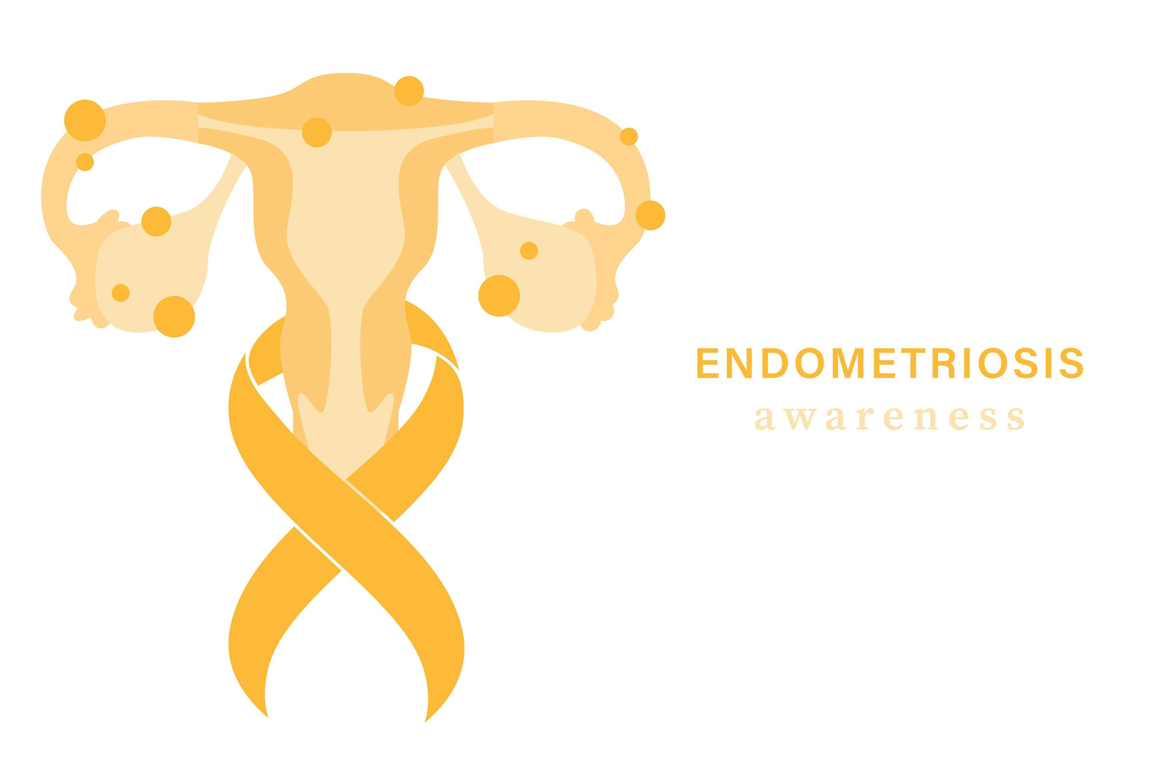 Honoring Endometriosis Awareness Month | Image Credit: © Katsiaryna Hatsak - © Katsiaryna Hatsak - stock.adobe.com