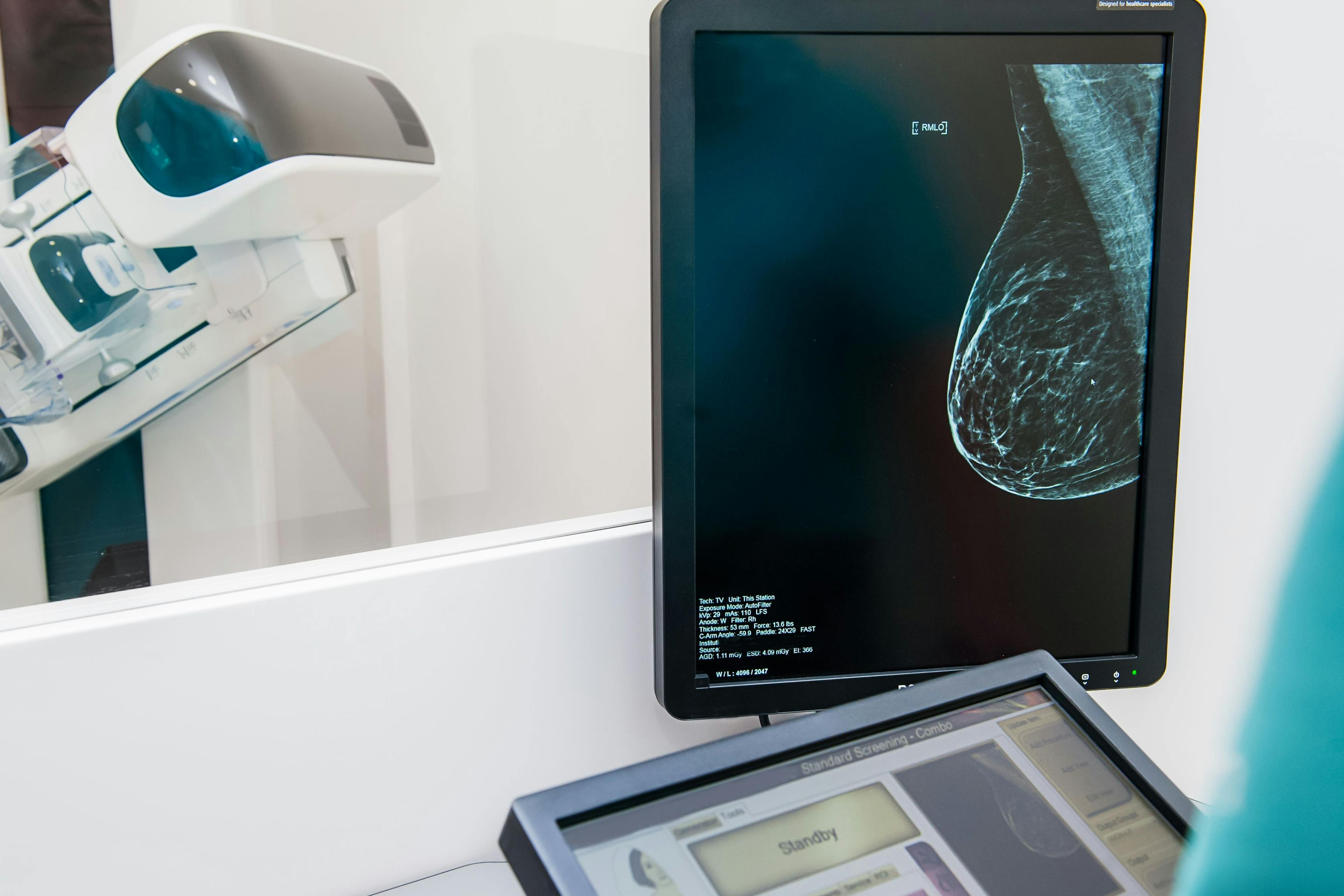 Breast cancer imaging