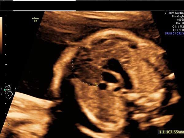 Image IQ: Anatomy of the Fetal Heart