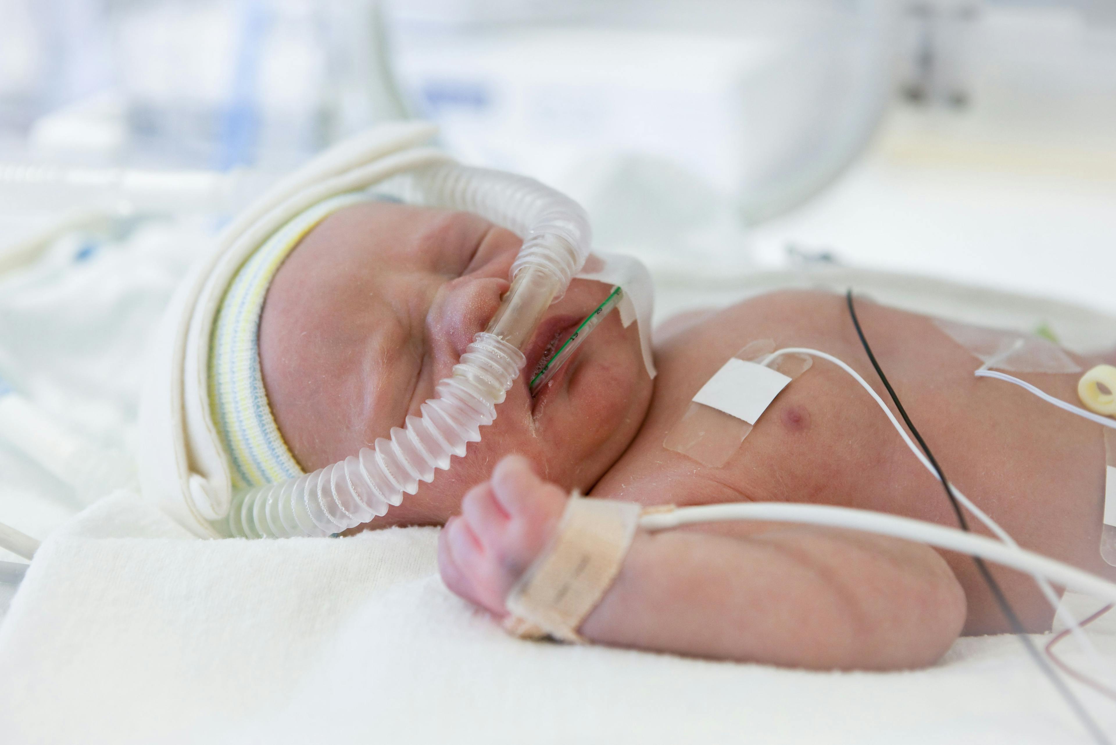 Can you guess the U.S. preterm birth rate?