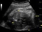 DailyDx: Fetal Heart Echo Quiz