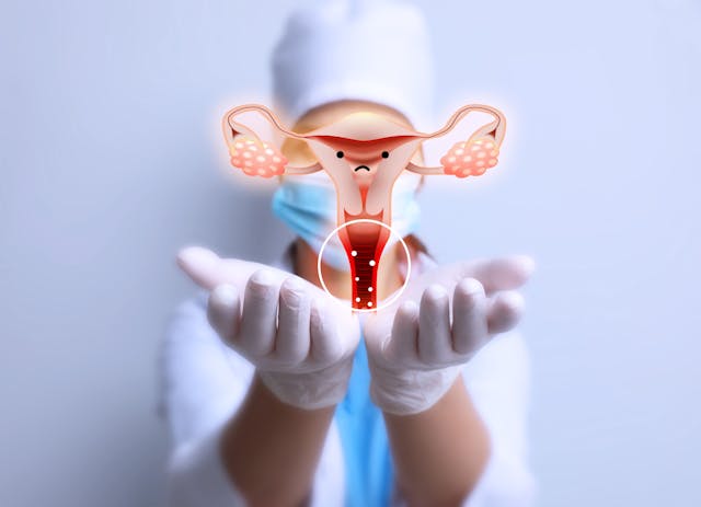 New system for detecting vulvovaginal candidiasis | Image Credit: © New Africa - © New Africa - stock.adobe.com.