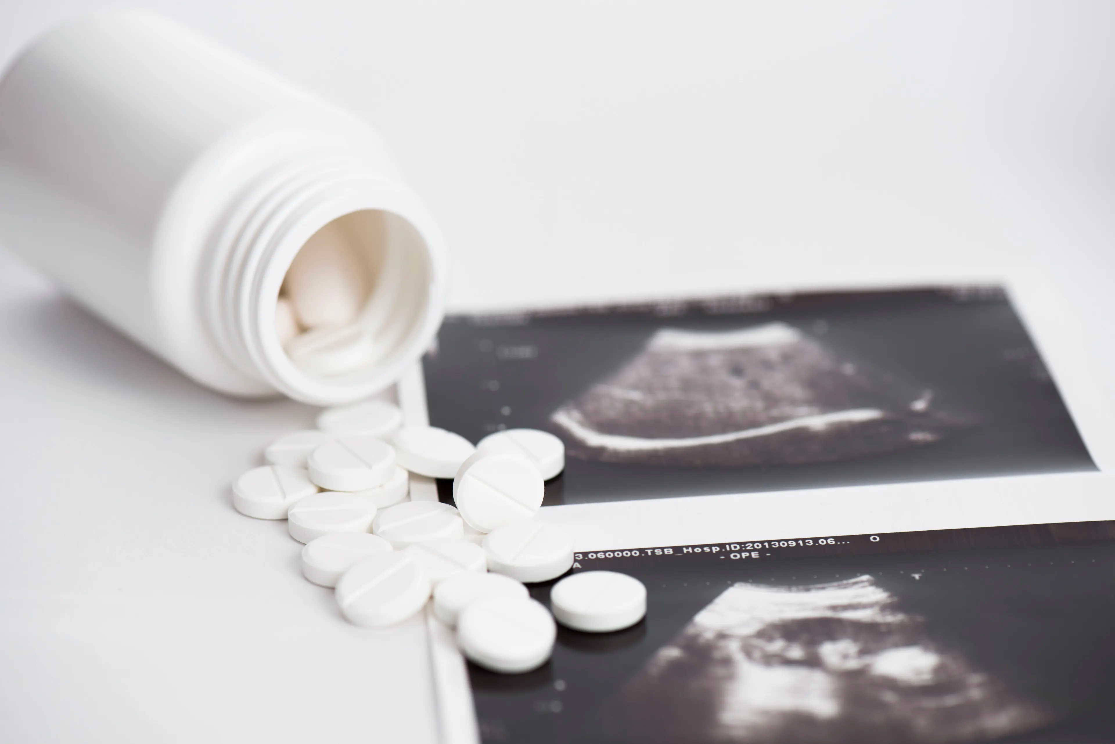 Misoprostol alone effective for abortion | Image Credit: © ivanko80 - © ivanko80 - stock.adobe.com.