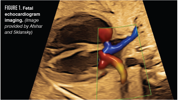 FIGURE 1. Fetal echocardiogram imaging. (Image provided by Afshar and Sklansky)