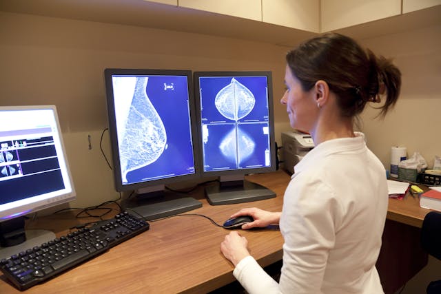 New AI tool may improve breast cancer screening