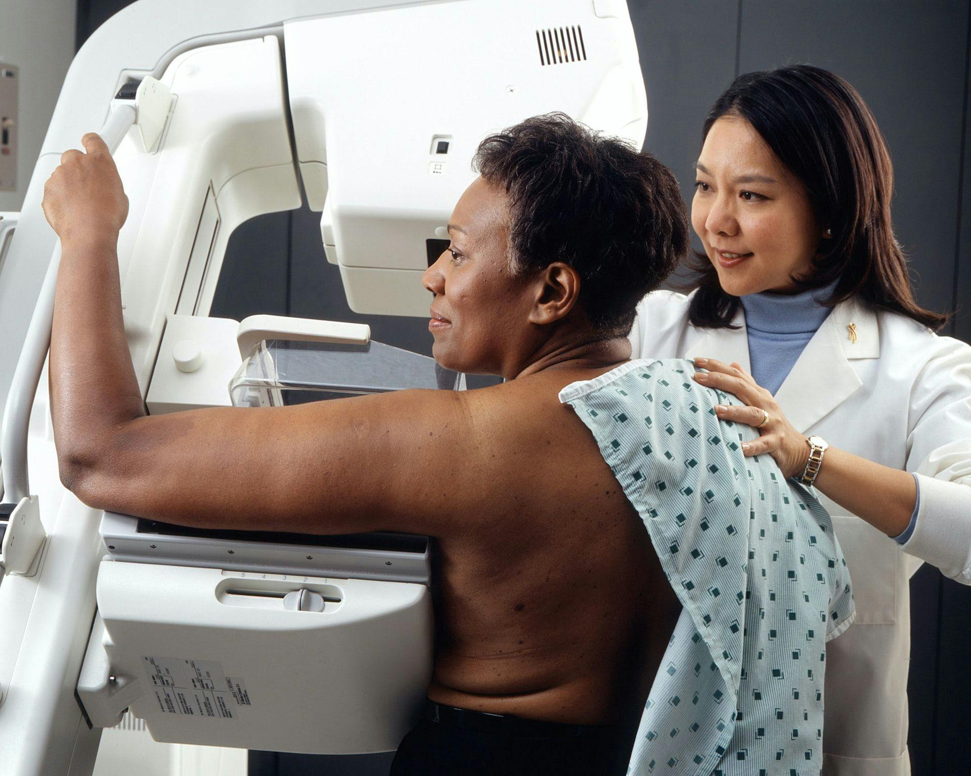 Mammography screening reduces rates of breast cancer mortality