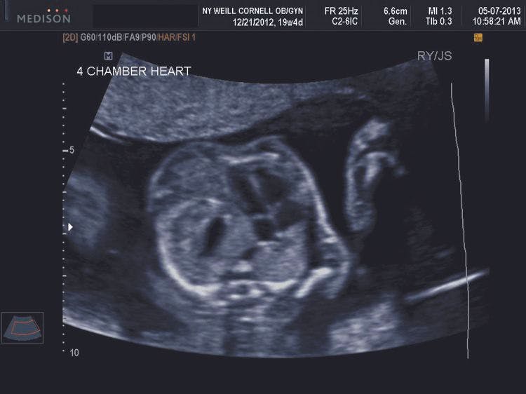 Ultrasounds images: Fetal anomalies of the first and second trimesters (Part 2)